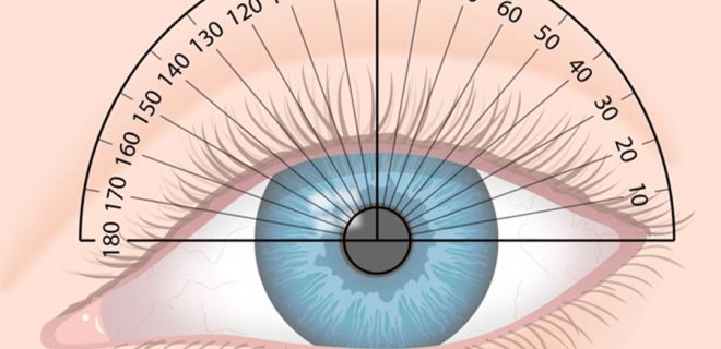 Astigmat Nedir