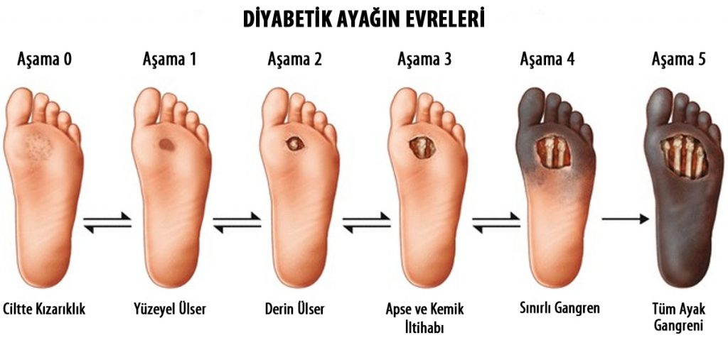 Ayak Nedir