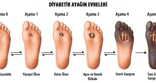 Ayak Nedir