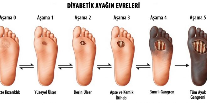 Ayak Nedir