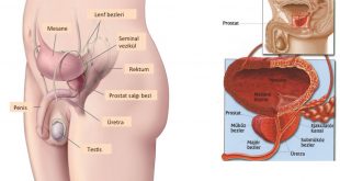 Prostat Nedir