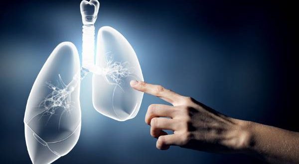 Akciğer Kanseri Belirtileri ve Tedavi Süreci