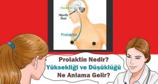 Prolaktin Yüksekliği Nedenleri