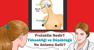 Prolaktin Yüksekliği Nedenleri